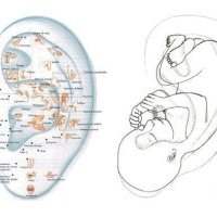 Le saviez vous ? Le pavillon de l'oreille, l'image foetal in utero ! 